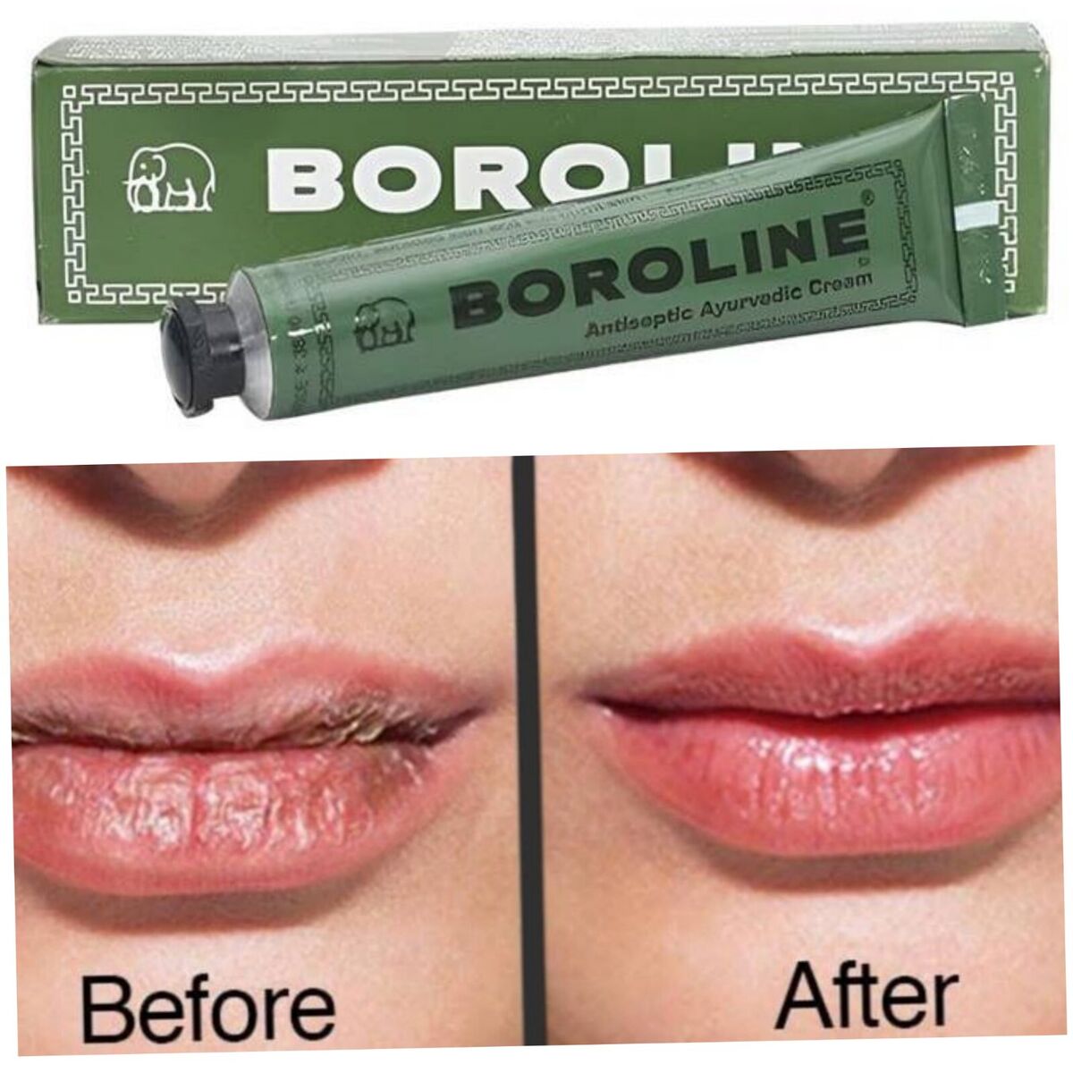 Boroline Antiseptic Cream 20 Gm(Pack of 6)
