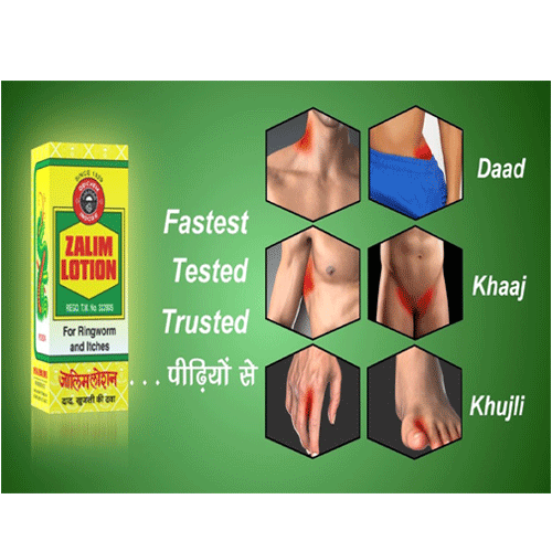 Orental Chemical Works Zalim Lotion 10 Ml (Pack of 20)