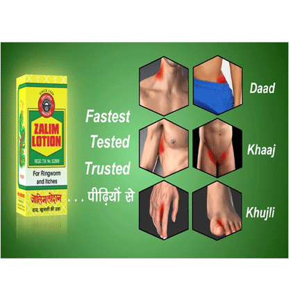 Orental Chemical Works Zalim Lotion 10 Ml (Pack of 20)